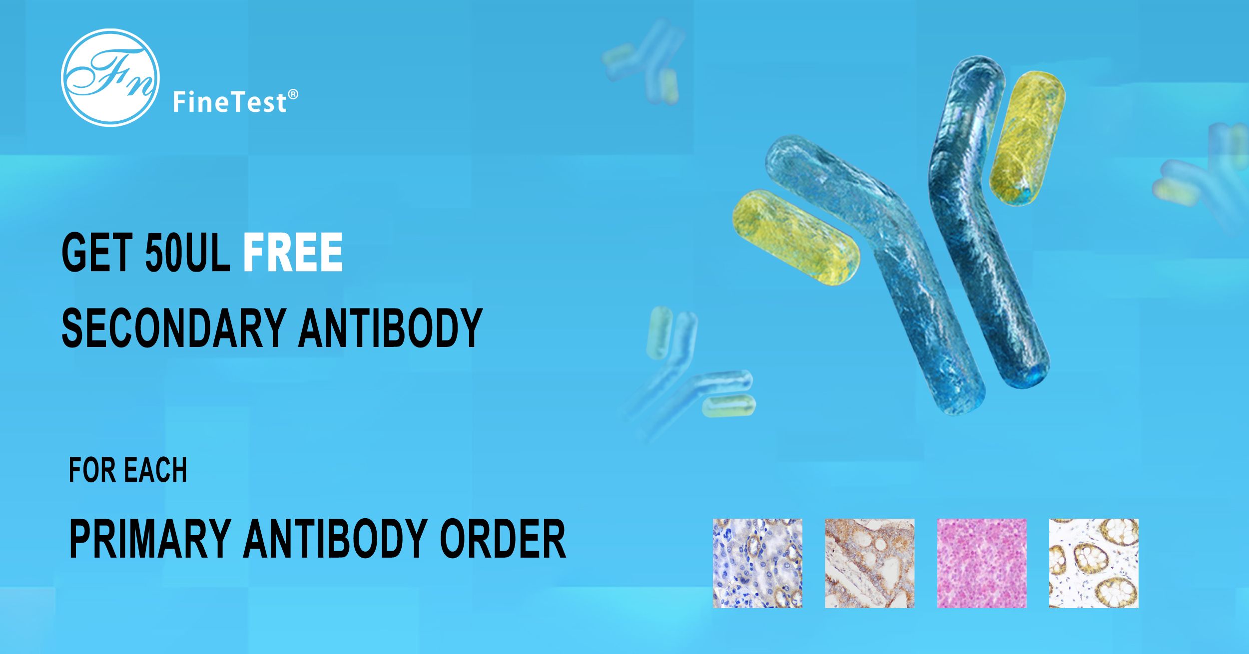 Buy Primary Antibody Get Free Secondary Antibody ELISA Kit