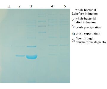 Prokaryotic Expression and Purification