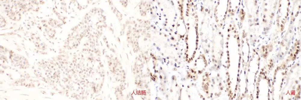 Immunohistochemistry