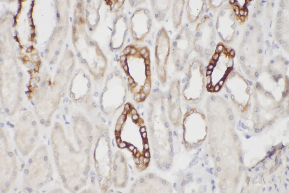 Immunohistochemistry Result_1