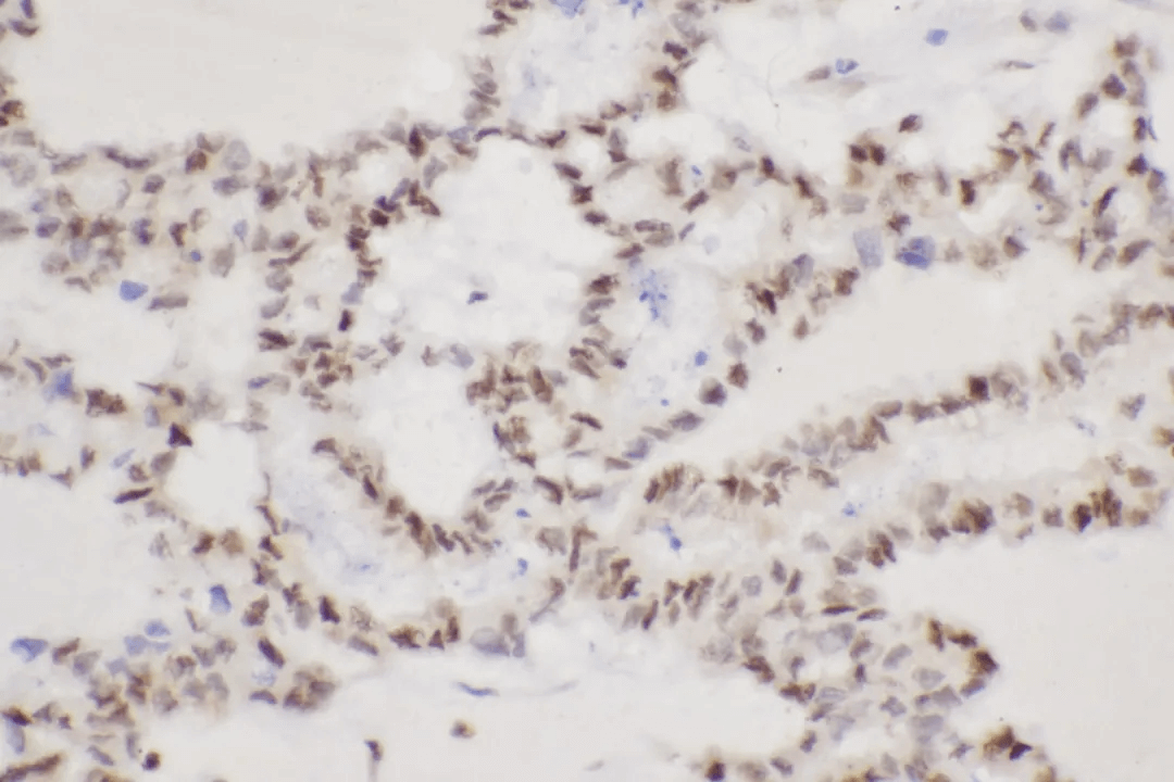 Immunohistochemistry Result_2