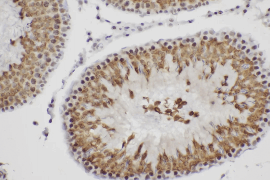 Immunohistochemistry Result_3