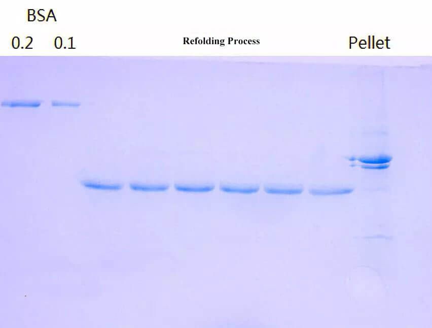 Inclusion Bodies Protein - Protein Refolding Process