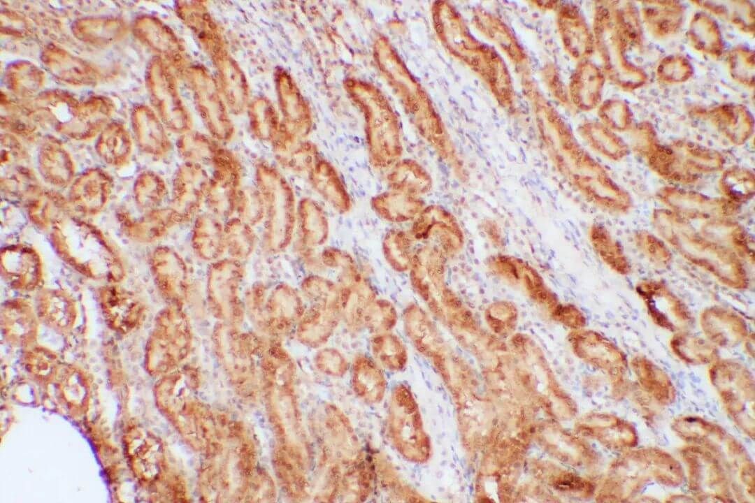 kidney immunostaining