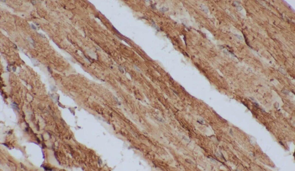 IHC Test for Rat Myocardial Tissue (Intermolecular Forces)