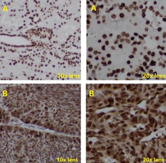 IHC Test Using Poly HRP Secondary Antibody_1