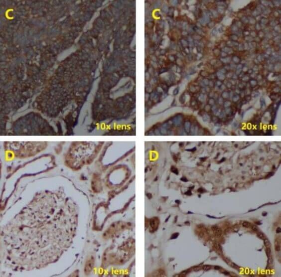 IHC Test Using Poly HRP Secondary Antibody_2