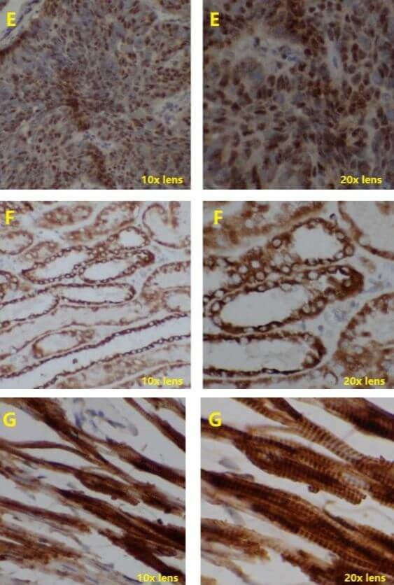 IHC Test Using Poly HRP Secondary Antibody_3