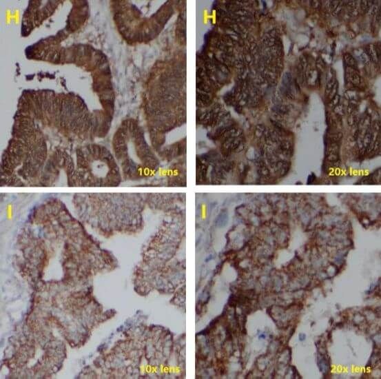 IHC Test Using Poly HRP Secondary Antibody_4