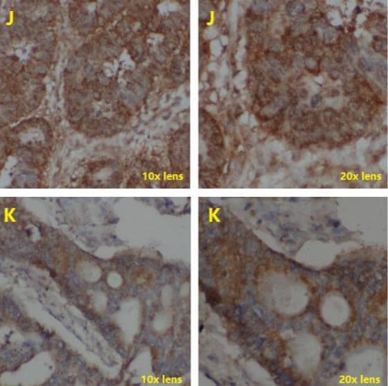 IHC Test Using Poly HRP Secondary Antibody_6