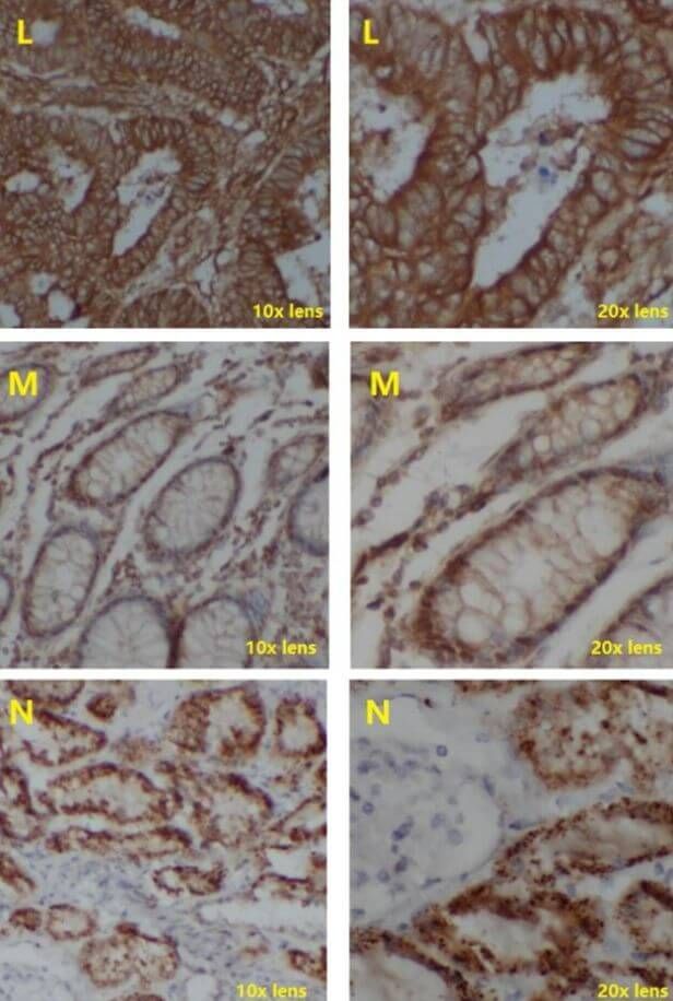 IHC Test Using Poly HRP Secondary Antibody_7