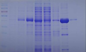 R250 Protein Staining