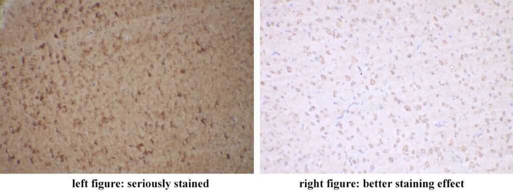 Immunohistochemistry Background Staining Effect