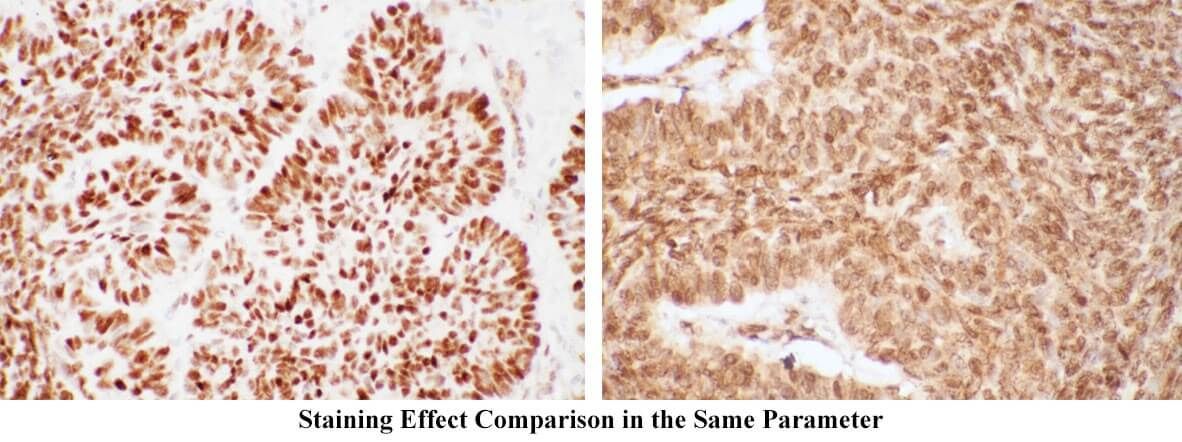 Immunohistochemistry Background Staining Comparison