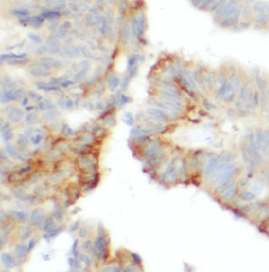 desmoglein-2-ihc