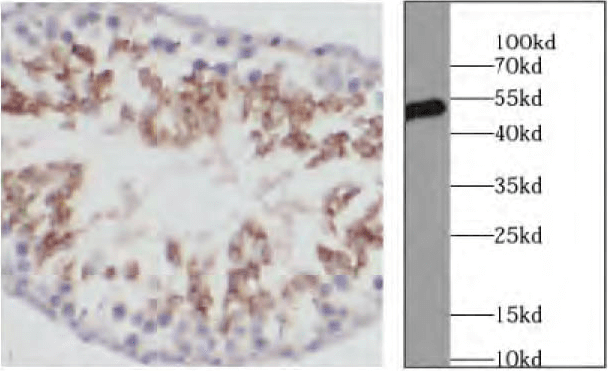 loading control antibodies - alpha Tubulin