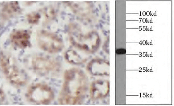 loading control antibodies - GAPDH