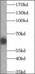 tag antibodies: GFP tag