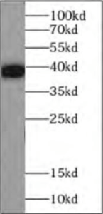 tag antibodies: MBP tag