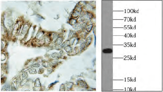 loading control antibodies - VDAC1