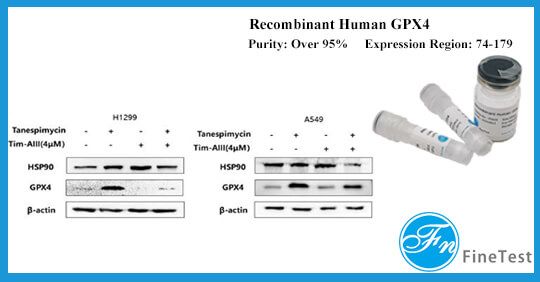 Non-small Cell Lung Cancer Treatment