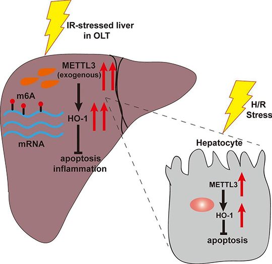 liver transplantation