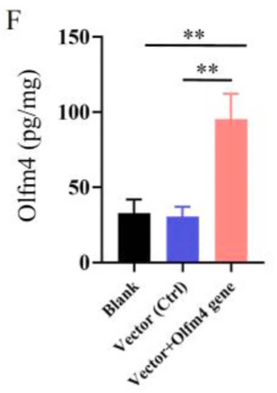 reperfusion injury