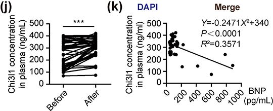 reperfusion injury