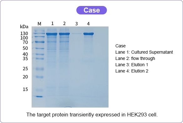 Mammalian Transient Protein Expression Case