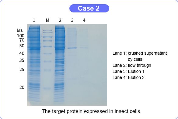 Baculovirus Insect Cell Expression Case 2