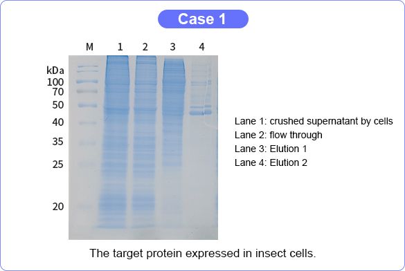 Baculovirus Insect Cell Expression Case 1
