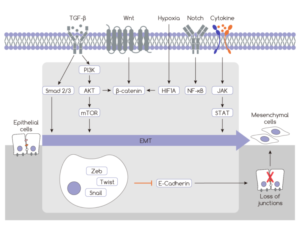E-Cadherin and EMT