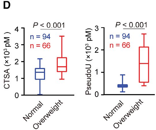 pancreatic ductal adenocarcinoma