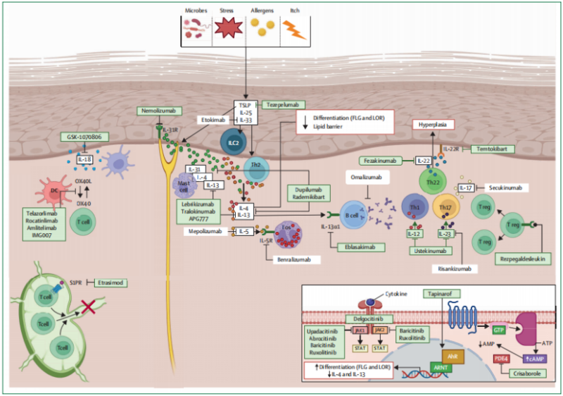 atopic dermatitis