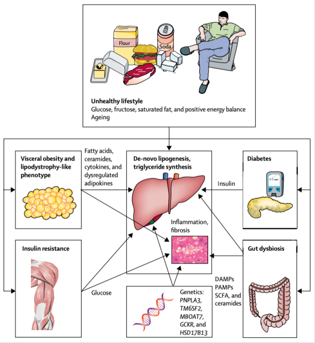 Causes of Fatty Liver