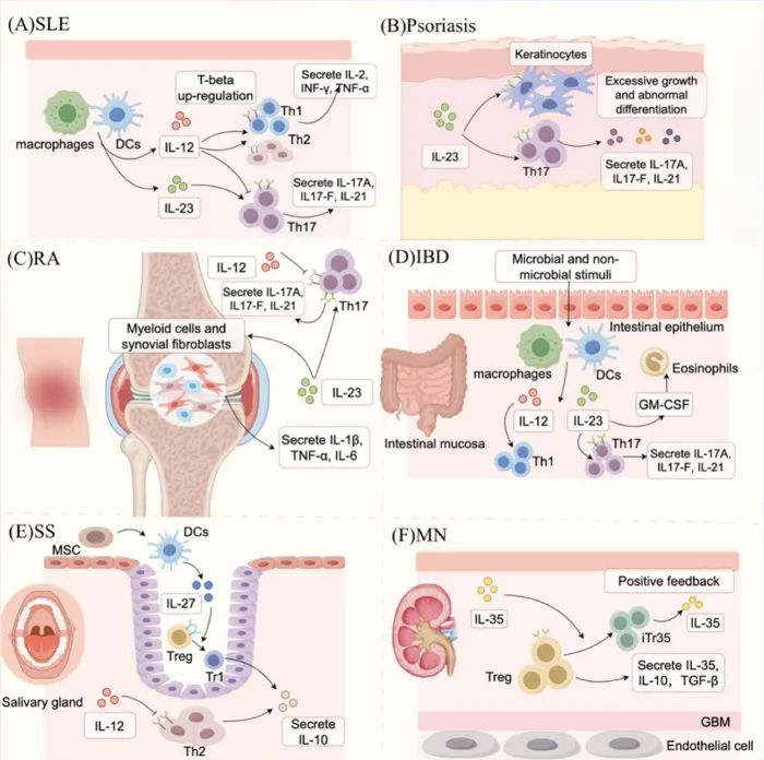 IL-12 in Various Diseases