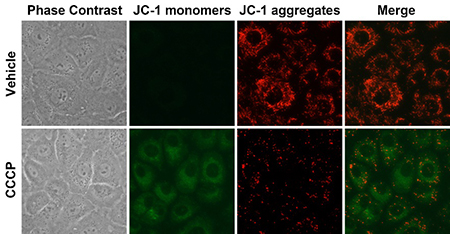 Mitochondrial Membrane Potential Detection