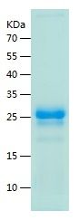 Recombinant Human copeptin