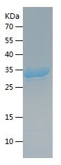 Recombinant Human ACACA