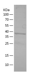 Recombinant Human ARR3