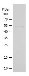 Recombinant Human CHAT