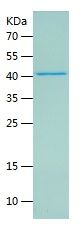 Recombinant Human PSMB9