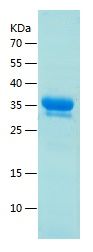 Recombinant Mouse HBB1