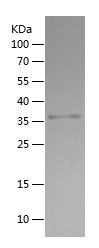 Recombinant Human DCX
