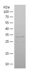 Recombinant Human SCIN
