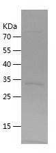 Recombinant Human ECI1