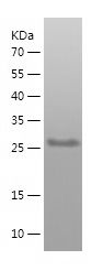 Recombinant Human EPB41L3