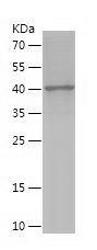 Recombinant Human BLOC1S6