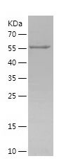 Recombinant Human CANX