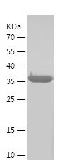 Recombinant Human STEAP4